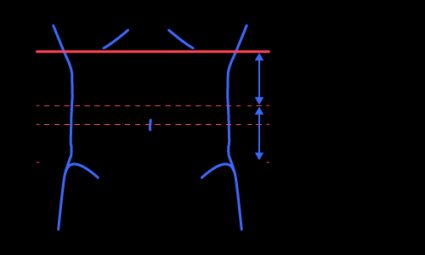 Showing, where to measure you waist circumference.