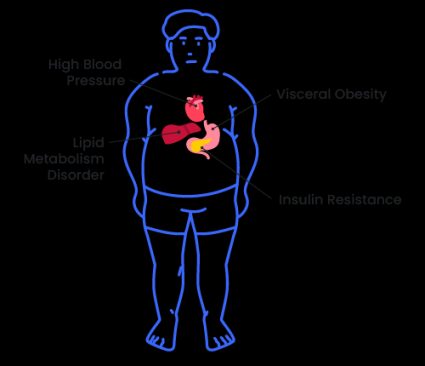 Illustration of the metabolic syndrome and its risk factors