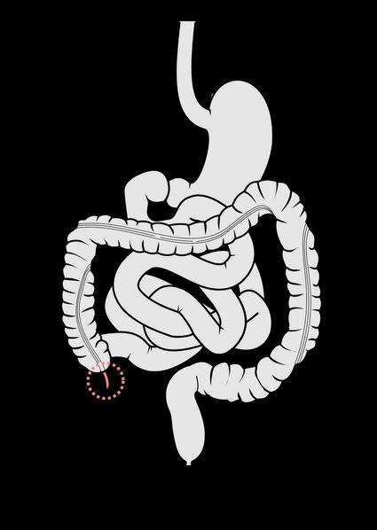 Image of appendix