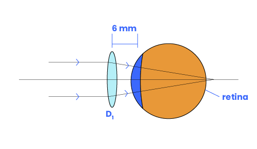 Contact Lens Vertex Calculator   Contact Lens Vertex 04 