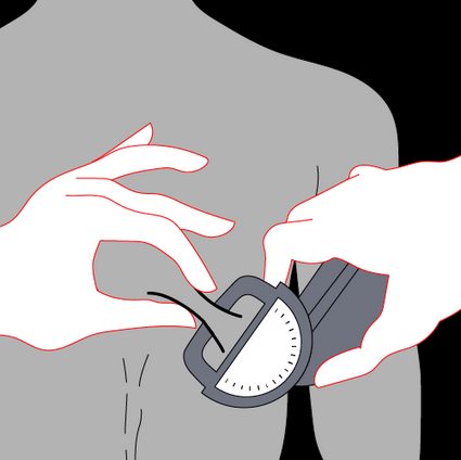 Image showing how to measure subscapular skinfold thickness.