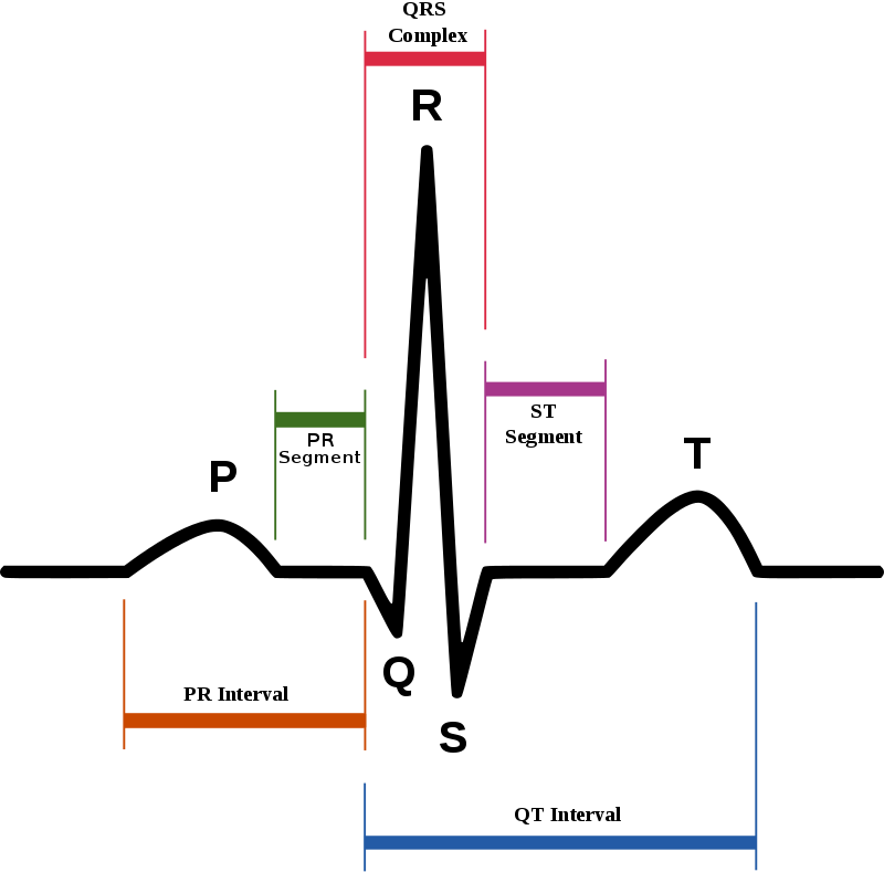 Representação esquemática de um ECG normal, com ondas, segmentos e intervalos rotulados