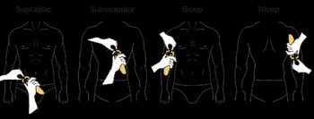 Image of skinfold measurement sites for male.