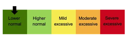 Sleepiness scale epworth.
